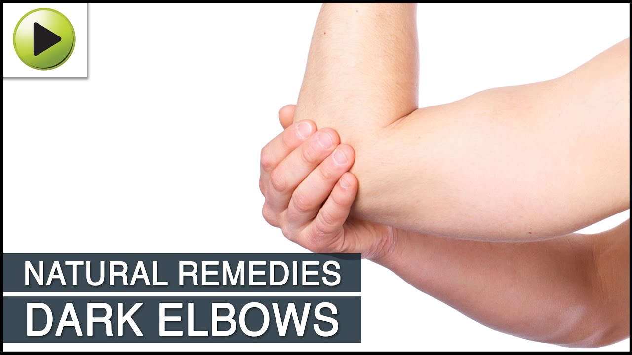 Dark Elbows – Natural Ayurvedic Home Remedies