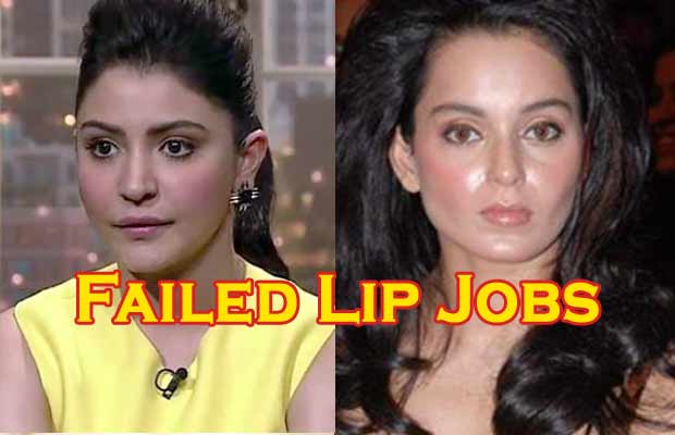Bollywood Lip-Jobs That Were Disasters!