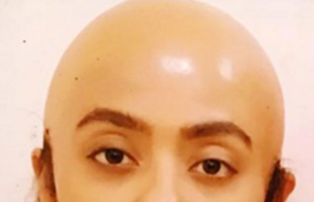 OMG! This Actress Goes Bald For Reality Show