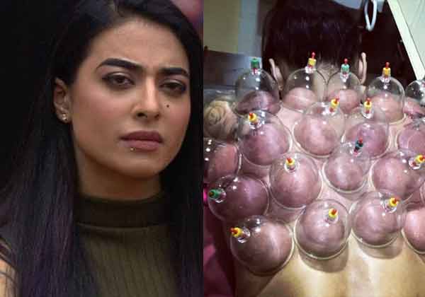 Pic: Bigg Boss Fame VJ Bani Goes Through Chinese Cupping Therapy For This Reason!